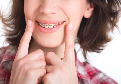 How Much Do Braces Cost Monthly? | West Windsor Orthodontics