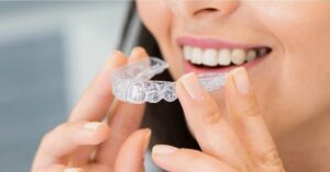 Learn Important Invisalign Facts