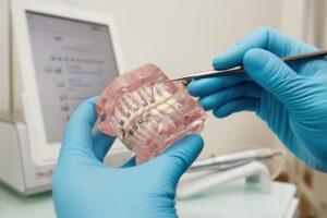 Broken Braces Brackets