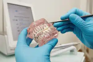 What Should You Do If A Bracket Or Wire Breaks On Your Braces? - Weston  Dental Office