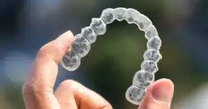 5 Invisalign facts