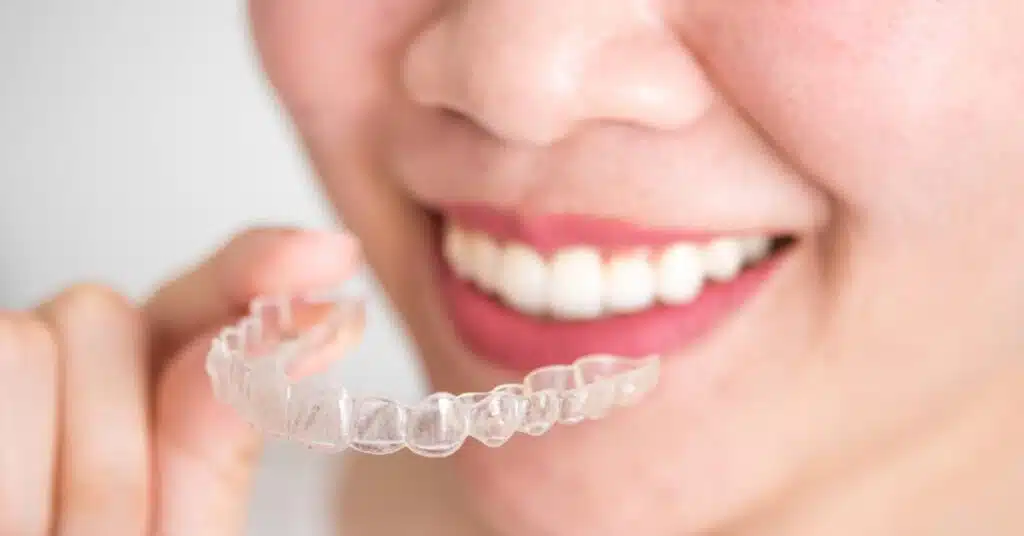 Invisalign facts