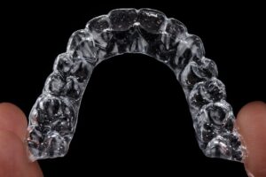 How Invisalign Works: A Complete Step-by-Step Guide