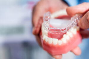 How Invisalign Works: A Complete Step-by-Step Guide