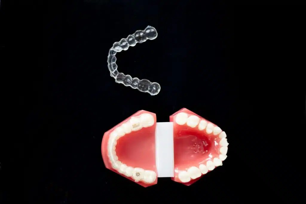 Invisalign with Dentures: Powerful Alternatives for Missing Teeth