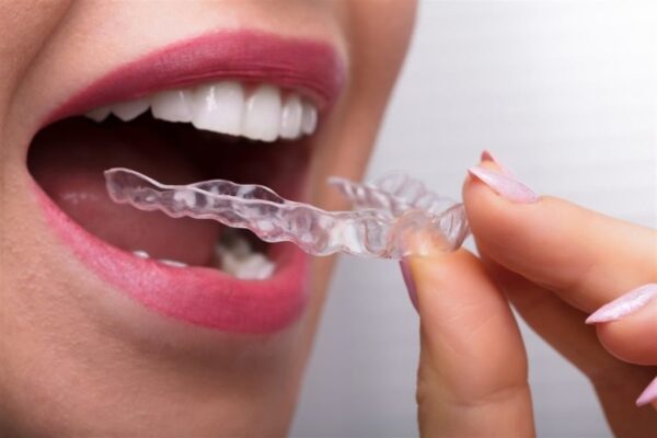 Invisalign is Changing the Game: Why It’s the Top Choice