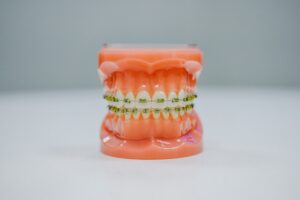 Different Types Of Dental Braces: Princeton &Amp; Hillsborough Guide