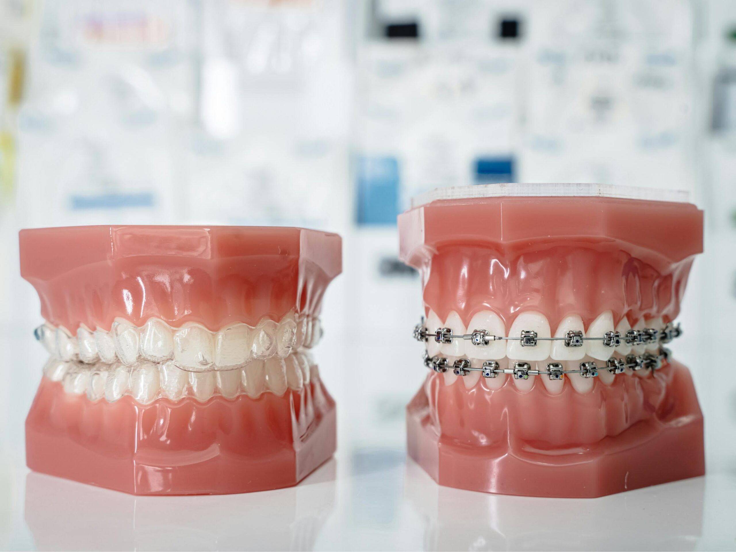 Invisalign Vs Traditional Braces: Expert Insight To Help You Decide