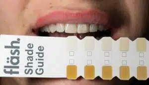 Teeth Whitening Guide: Smart Options Patients Trust in 2025