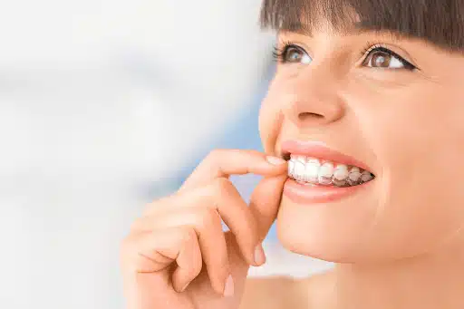 Hidden benefits of Invisalign treatment