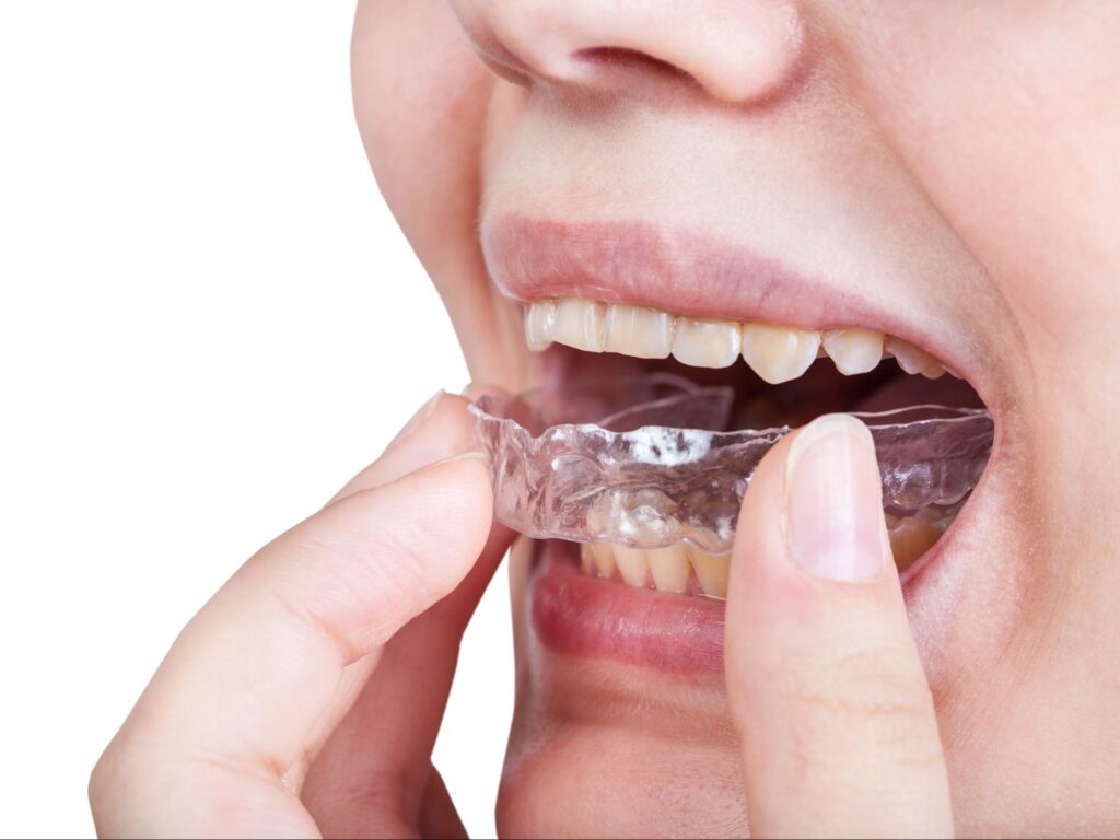 adult patient wearing clear aligners near Pennington NJ
